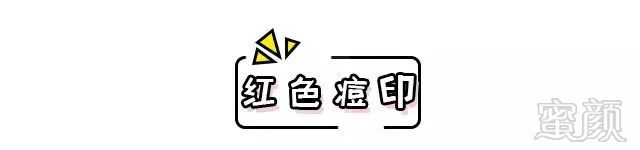 https://img.miyanlife.com/mnt/timg/190114/1220221208-2.jpg