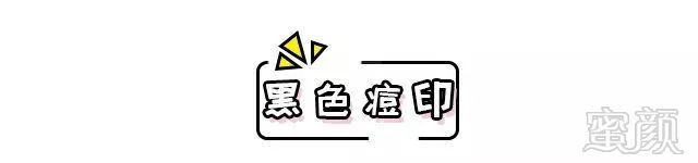 https://img.miyanlife.com/mnt/timg/190114/1220236134-4.jpg