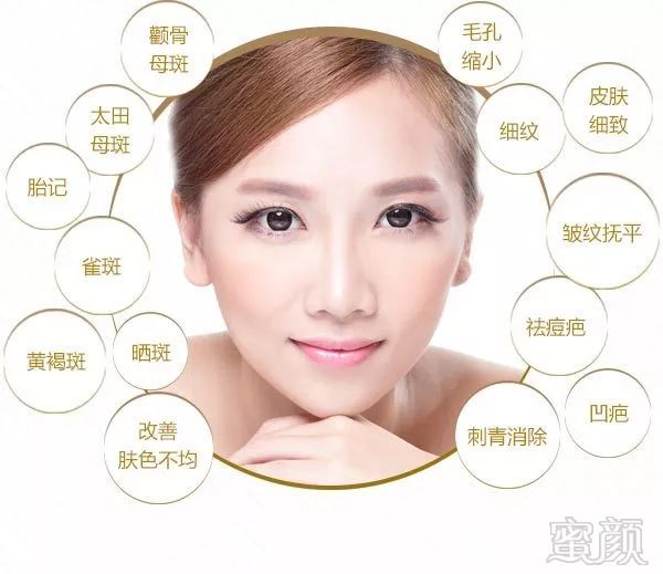 https://img.miyanlife.com/mnt/timg/190114/125S24118-1.jpg