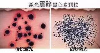 https://img.miyanlife.com/mnt/timg/190114/125S3H63-4.jpg