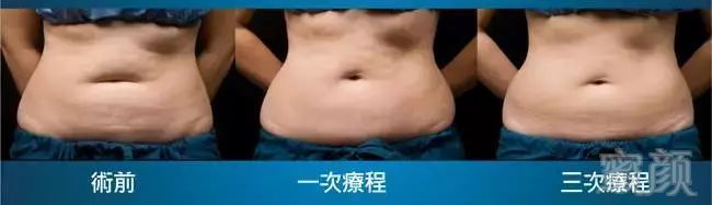 https://img.miyanlife.com/mnt/timg/190115/1226292X8-4.jpg