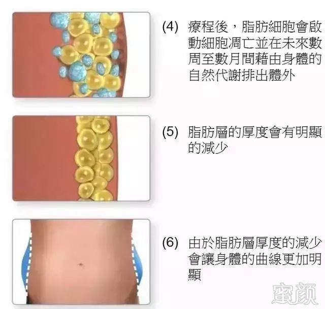 https://img.miyanlife.com/mnt/timg/190115/1226296253-6.jpg