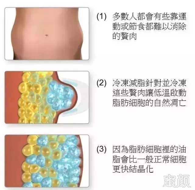 https://img.miyanlife.com/mnt/timg/190115/1226296341-5.jpg