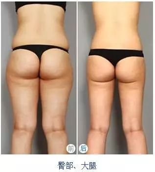 https://img.miyanlife.com/mnt/timg/190115/1226302334-11.jpg
