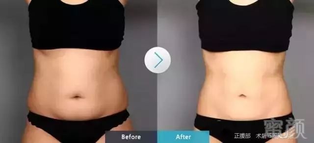 https://img.miyanlife.com/mnt/timg/190115/1226304B2-8.jpg