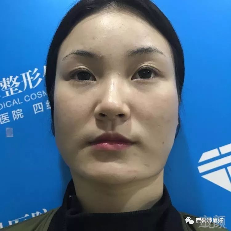 https://img.miyanlife.com/mnt/timg/190115/122S11138-0.jpg