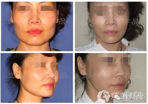 https://img.miyanlife.com/mnt/timg/190115/12300R137-3.jpg