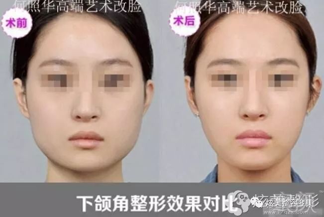 https://img.miyanlife.com/mnt/timg/190115/12300UE6-2.jpg