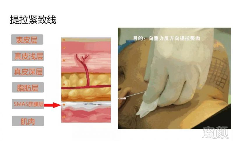 https://img.miyanlife.com/mnt/timg/190115/1255495Y2-2.jpg