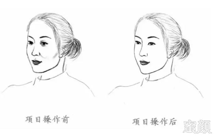 https://img.miyanlife.com/mnt/timg/190116/11234B095-5.jpg