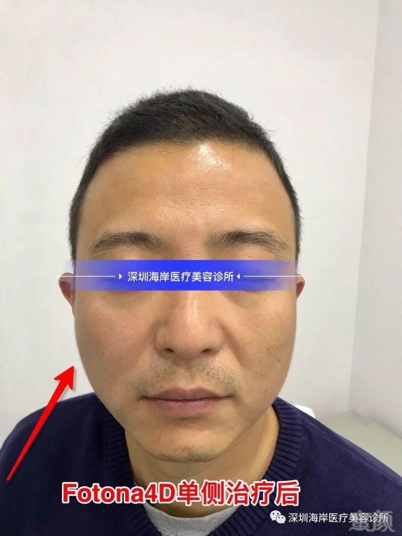 https://img.miyanlife.com/mnt/timg/190116/11420a534-7.jpg