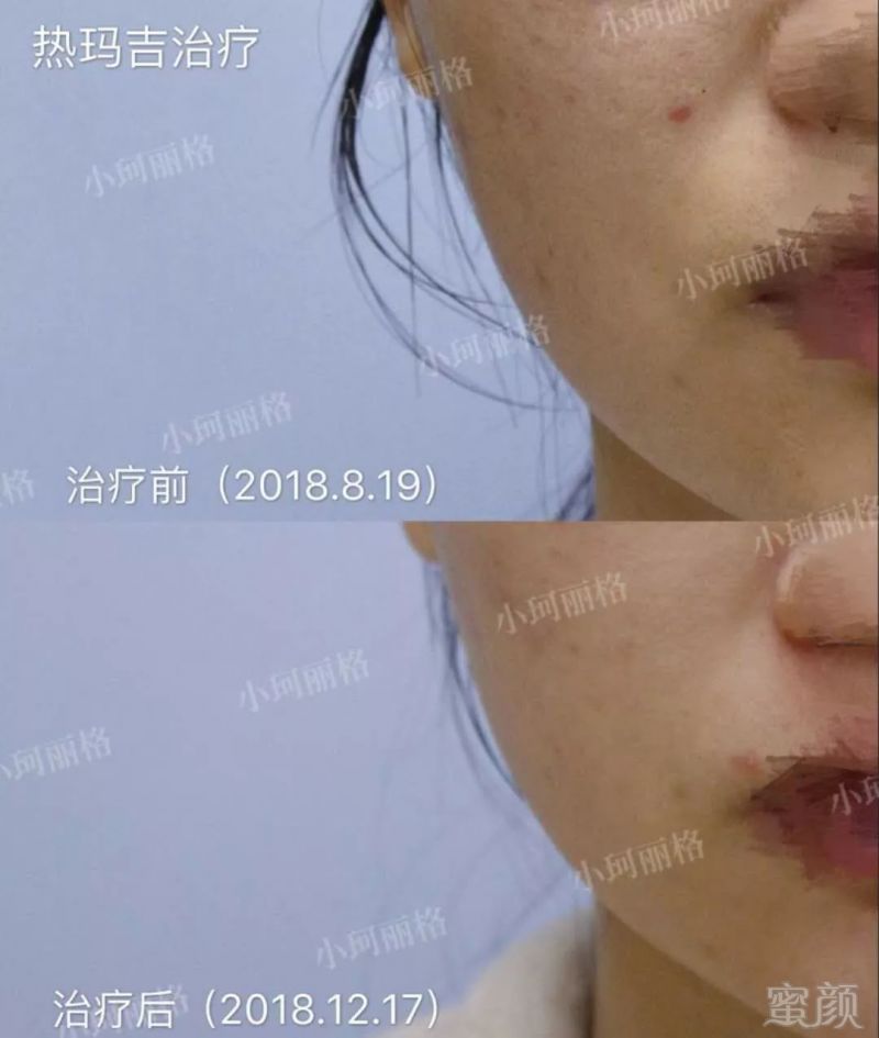 https://img.miyanlife.com/mnt/timg/190116/1236061O6-15.jpg