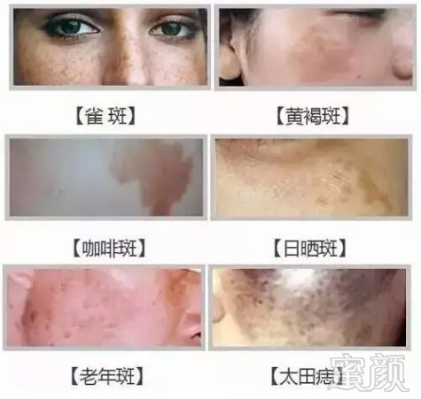 https://img.miyanlife.com/mnt/timg/190116/1252414913-5.jpg