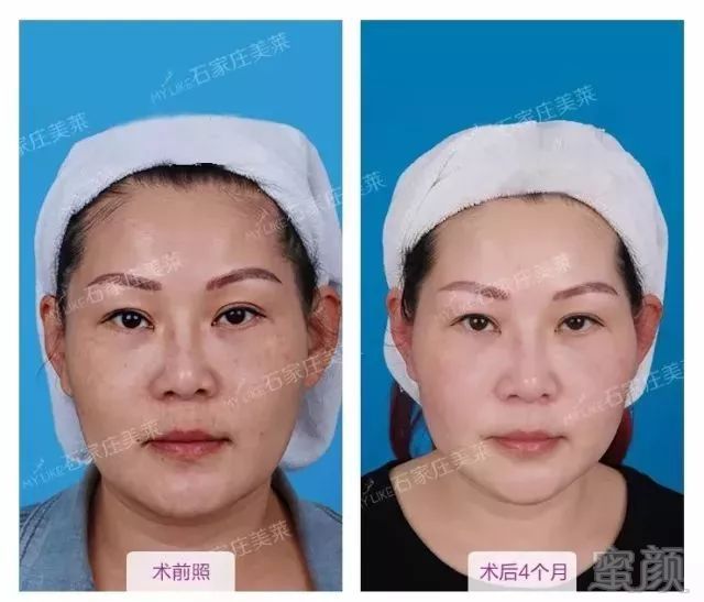 https://img.miyanlife.com/mnt/timg/190116/12524153F-8.jpg