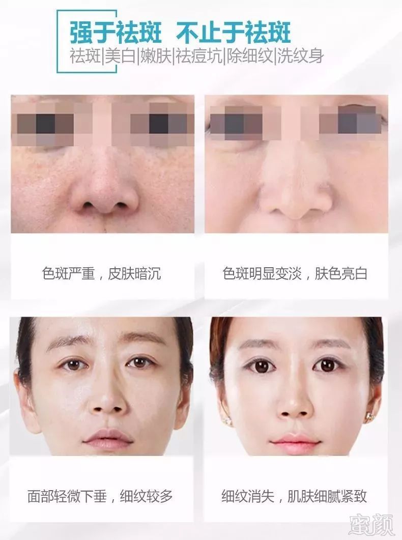 https://img.miyanlife.com/mnt/timg/190116/1252422311-13.jpg