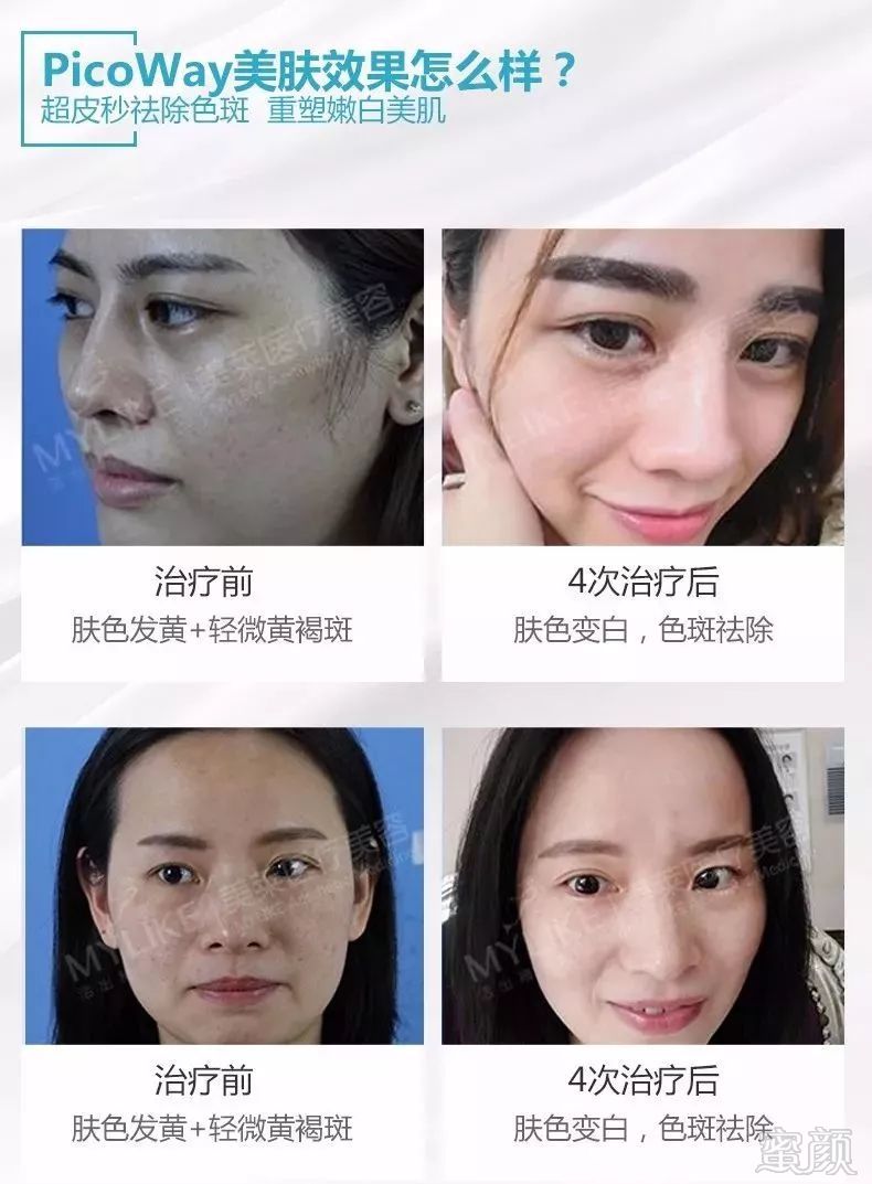 https://img.miyanlife.com/mnt/timg/190116/1252422R3-12.jpg