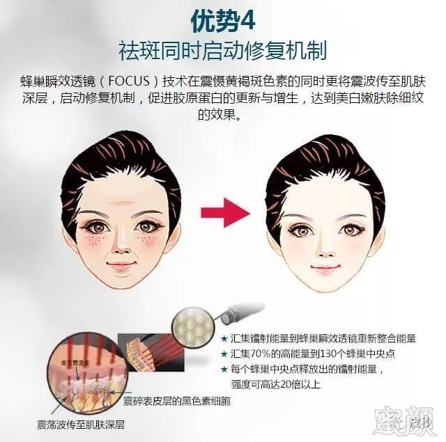 https://img.miyanlife.com/mnt/timg/190117/12095451O-8.jpg