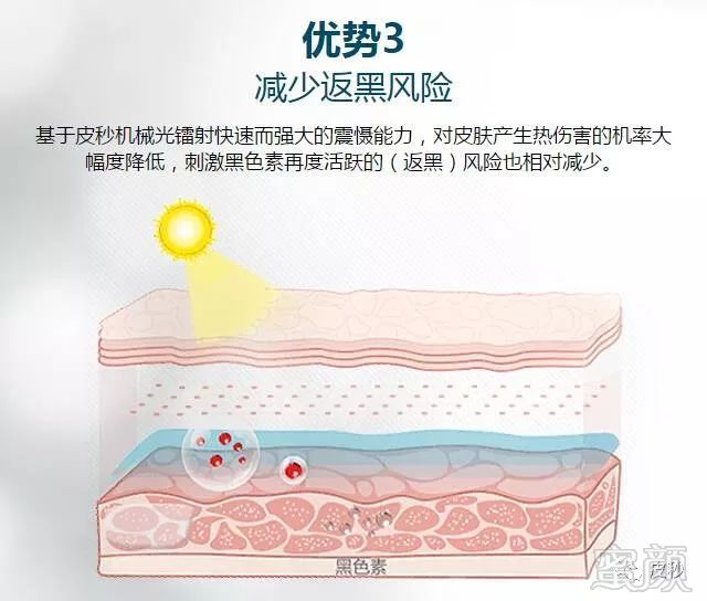 https://img.miyanlife.com/mnt/timg/190117/1209545443-7.jpg