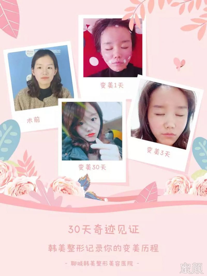 https://img.miyanlife.com/mnt/timg/190117/1250454625-8.jpg