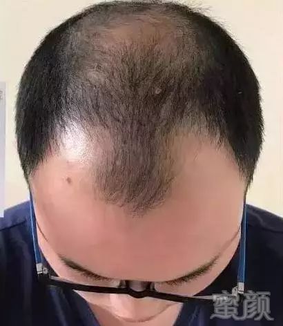 https://img.miyanlife.com/mnt/timg/190117/1311331064-3.jpg