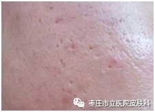 https://img.miyanlife.com/mnt/timg/190117/13191AL0-6.jpg