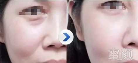 https://img.miyanlife.com/mnt/timg/190117/13362T541-10.jpg