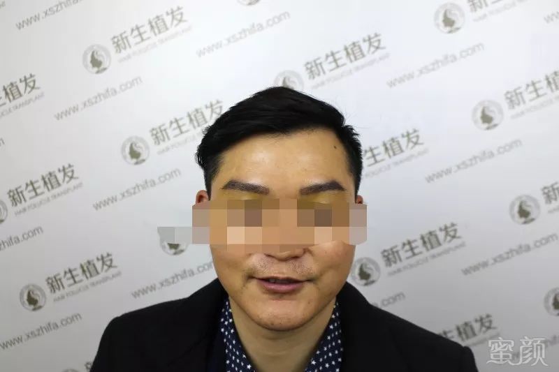 https://img.miyanlife.com/mnt/timg/190118/1243342249-3.jpg