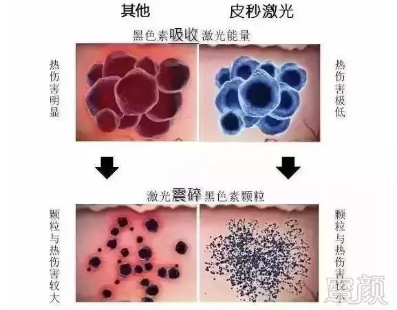 https://img.miyanlife.com/mnt/timg/190119/1020401G4-3.jpg