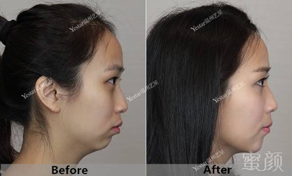 https://img.miyanlife.com/mnt/timg/190120/105ZM1P-5.jpg