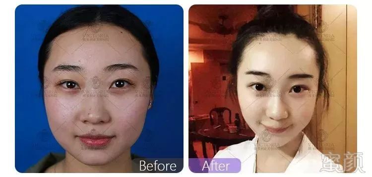 https://img.miyanlife.com/mnt/timg/190120/112R931M-3.jpg