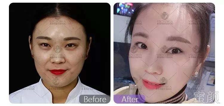 https://img.miyanlife.com/mnt/timg/190120/112S02O4-4.jpg