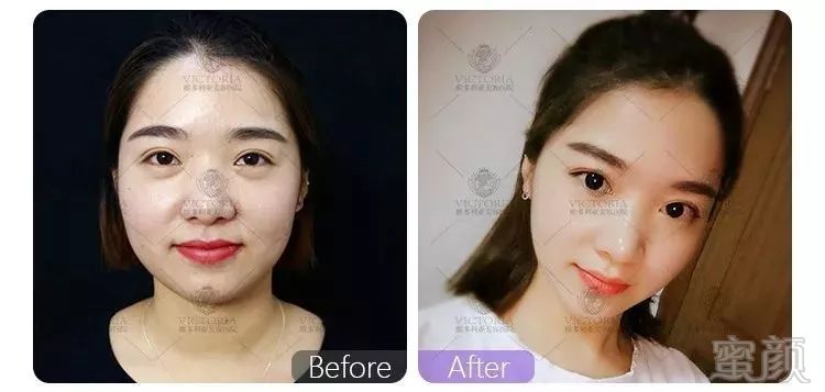 https://img.miyanlife.com/mnt/timg/190120/112S045a-5.jpg