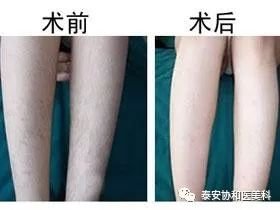 https://img.miyanlife.com/mnt/timg/190122/122R15C1-3.jpg