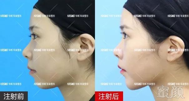 https://img.miyanlife.com/mnt/timg/190122/1305012015-3.jpg