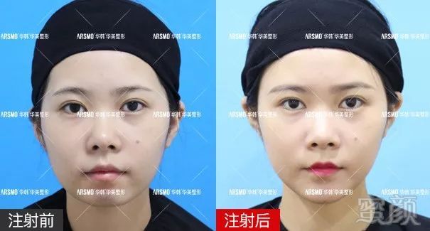 https://img.miyanlife.com/mnt/timg/190122/130501A62-2.jpg