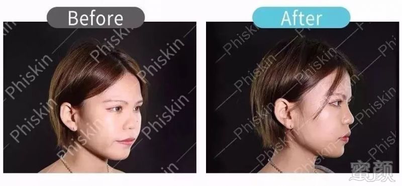 https://img.miyanlife.com/mnt/timg/190123/1035004227-7.jpg