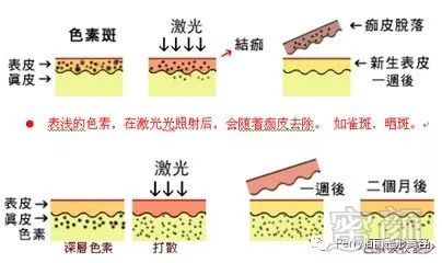 案例图片