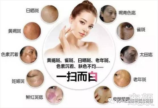 https://img.miyanlife.com/mnt/timg/190123/12545IR1-5.jpg