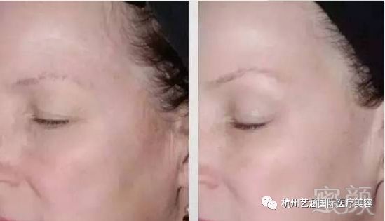 https://img.miyanlife.com/mnt/timg/190123/12545M5I-6.jpg
