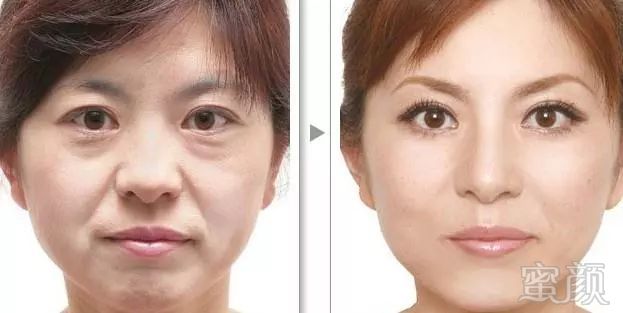 https://img.miyanlife.com/mnt/timg/190123/13051Q337-5.jpg