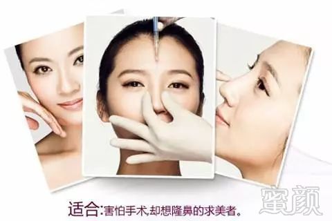 https://img.miyanlife.com/mnt/timg/190123/13051Q963-7.jpg