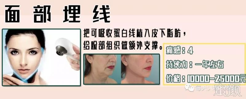 https://img.miyanlife.com/mnt/timg/190124/111H554D-2.jpg
