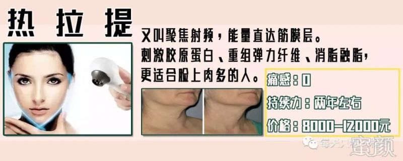 https://img.miyanlife.com/mnt/timg/190124/111H92953-5.jpg