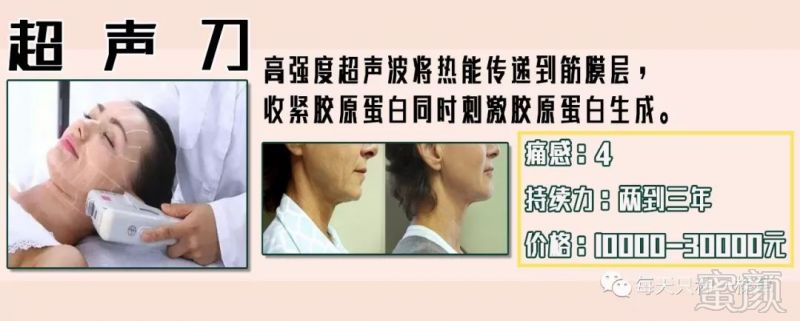 https://img.miyanlife.com/mnt/timg/190124/111HMb3-4.jpg