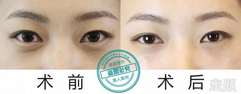 https://img.miyanlife.com/mnt/timg/190124/1220501500-2.jpg
