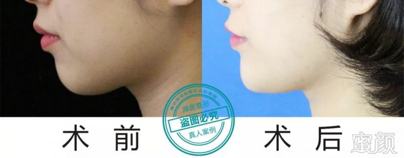 https://img.miyanlife.com/mnt/timg/190124/12205034E-3.jpg