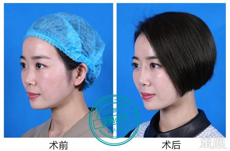 https://img.miyanlife.com/mnt/timg/190124/122050N47-5.jpg