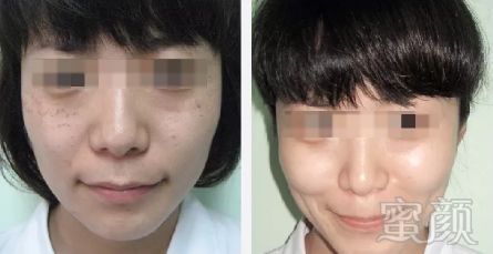 https://img.miyanlife.com/mnt/timg/190124/12231TZ1-4.jpg