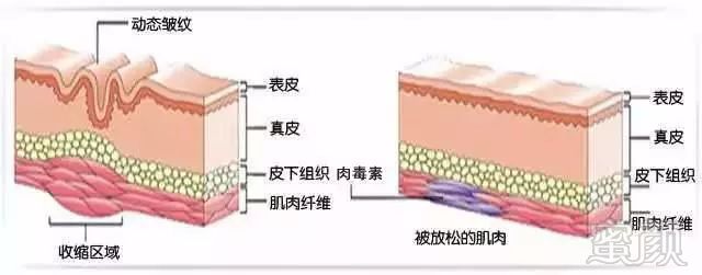 案例图片