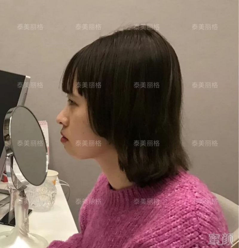 https://img.miyanlife.com/mnt/timg/190124/123H94194-1.jpg